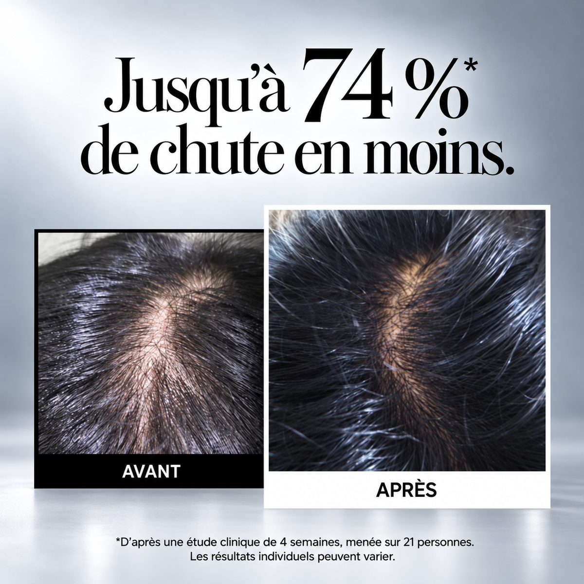 Ampoule Cuir Chevelu Fortifiante — 150 ml